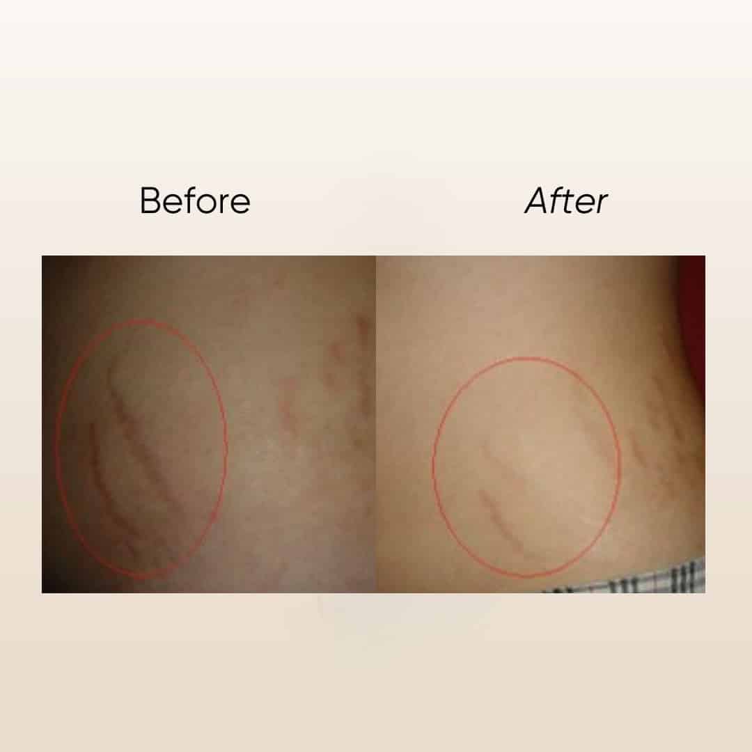 hoppi 100% natural oats baby bath & lotion bundle (copy)