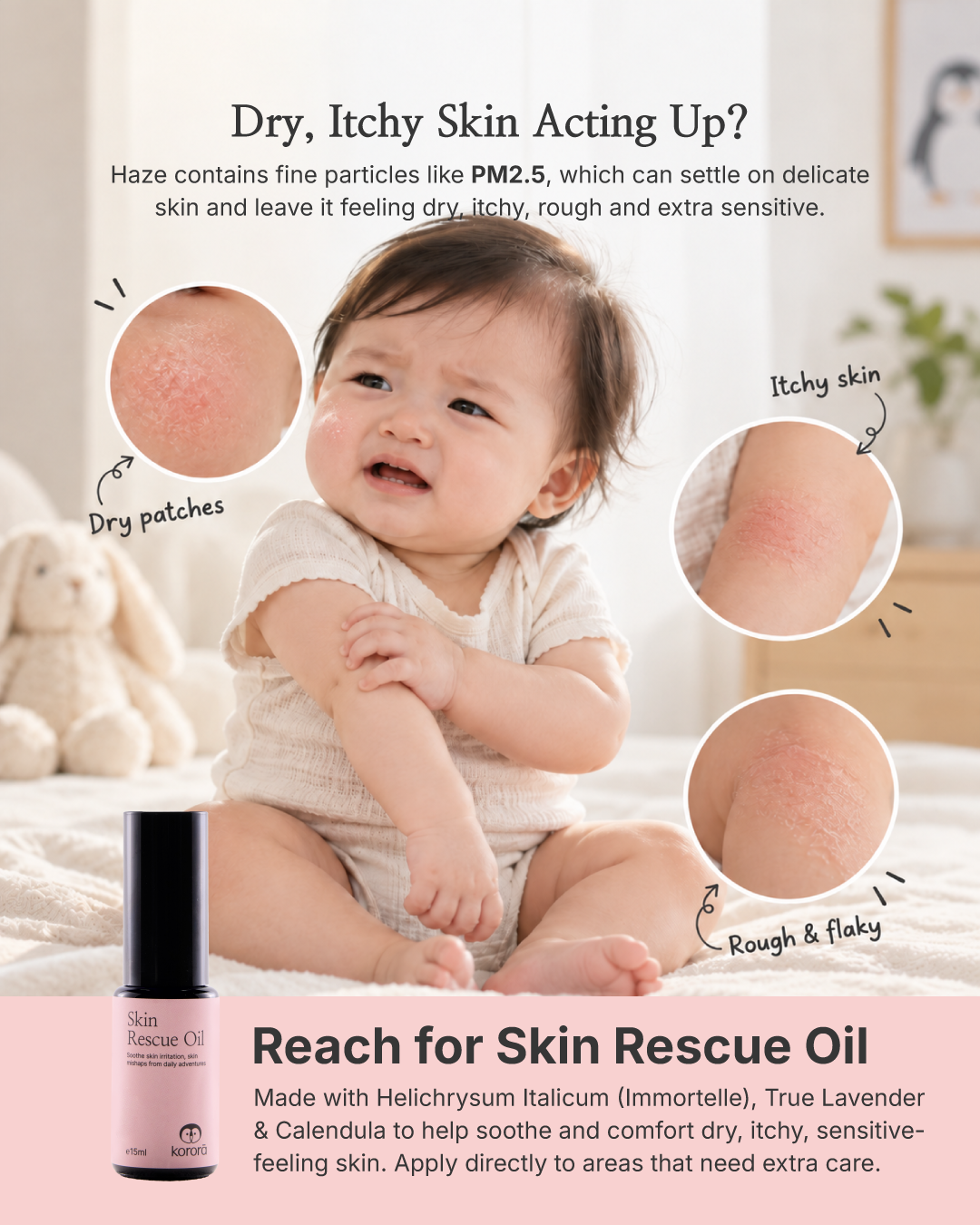 Korora Baby Haze SOS Kit | EucaBoost Oil + Skin Rescue Oil for Stuffy Nose & Dry, Itchy Skin