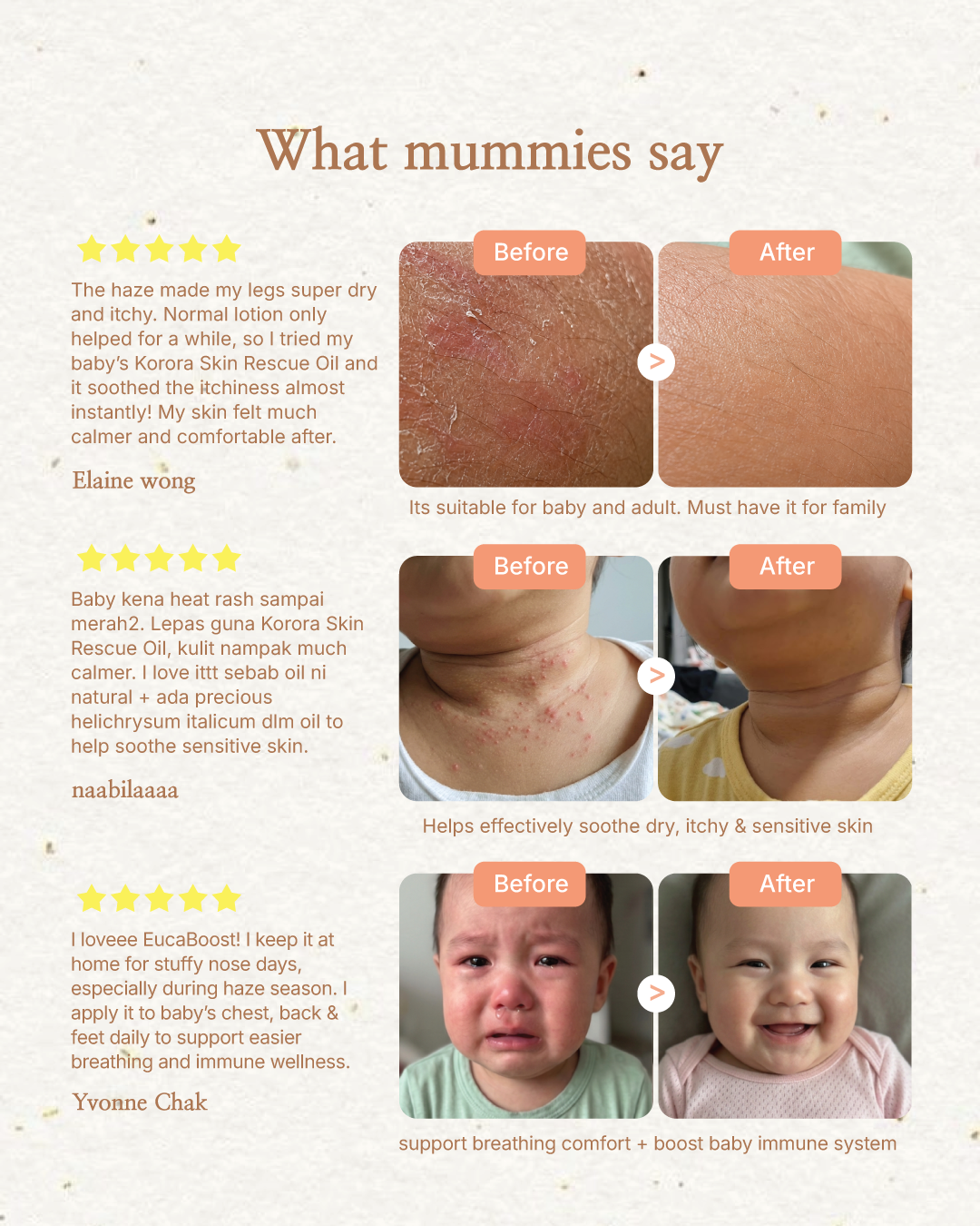 Korora Baby Haze SOS Kit | EucaBoost Oil + Skin Rescue Oil for Stuffy Nose & Dry, Itchy Skin