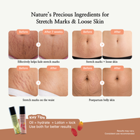 Korora Mom Series | Stretch Me Not Oil & Firm Me Up Lotion