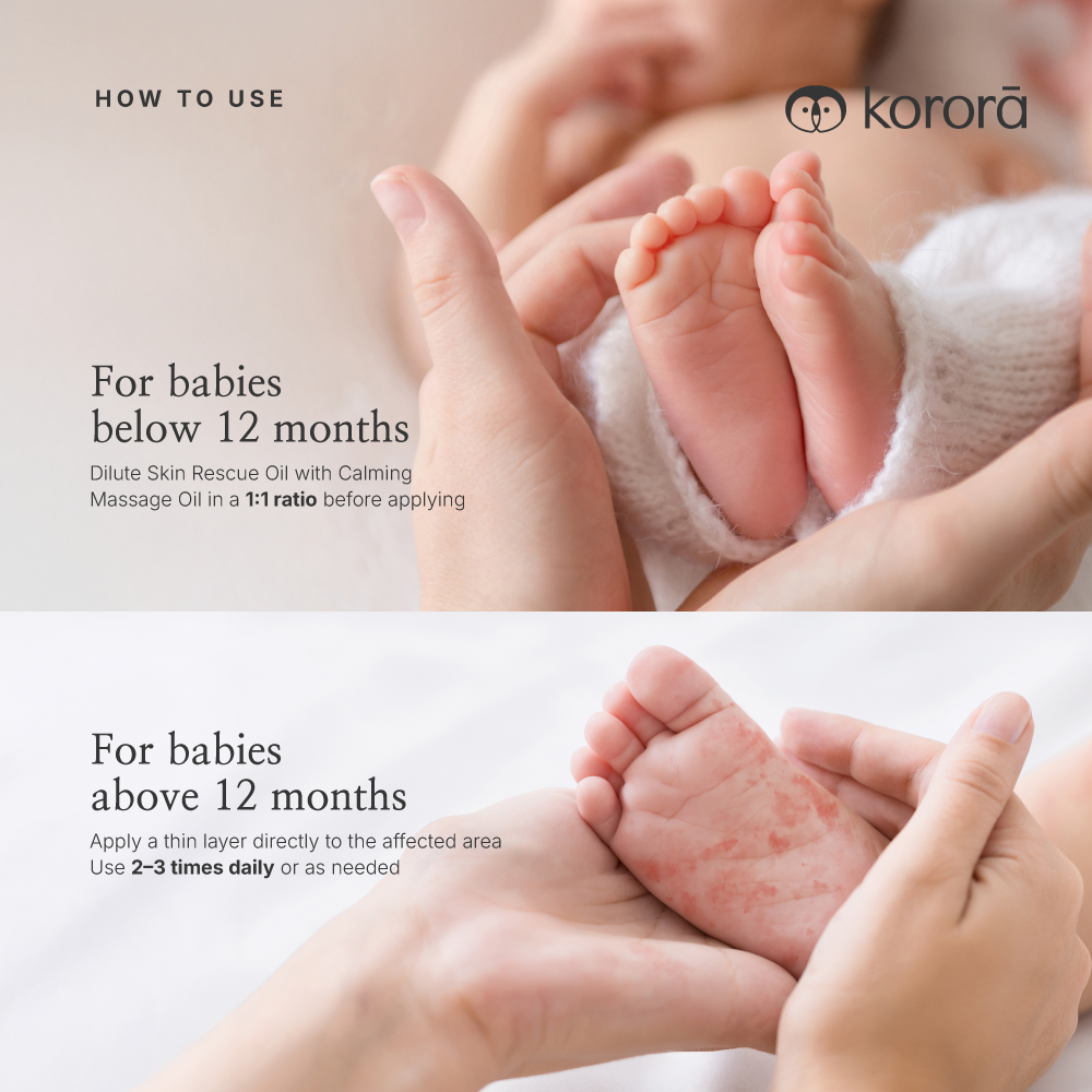Korora Skin Rescue Oil 15ml | Soothes Dry, Irritated & Sensitive Skin | Minyak Kulit Sensitif Bayi | 婴儿敏感皮肤舒缓修护油